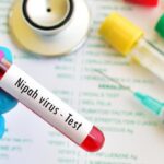 Kemenkes Pastikan Nihil Kasus Virus Nipah di RI, Pengawasan Diperketat