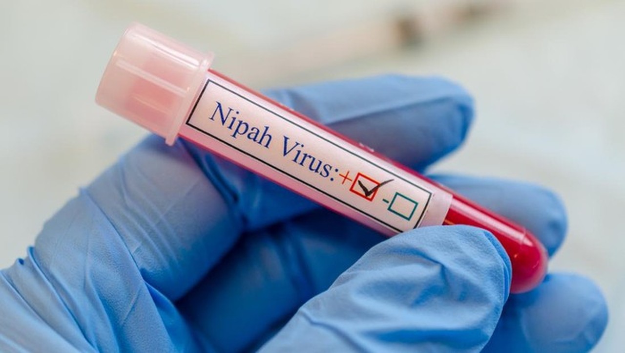 Waspada Virus Nipah Mematikan, Dinkes DKI Ingatkan Warga Pencegahan Kontak Hewan dan Makanan Terkontaminasi