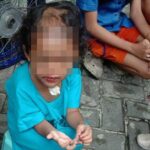 Balita di Surabaya Dianiaya dan Dibotaki Paman-Bibi, Polisi Dalami Motif