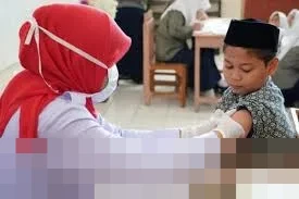 Kemenkes Perketat Deteksi dan Imunisasi Campak Usai Dua WNA Terkonfirmasi Positif dari Indonesia